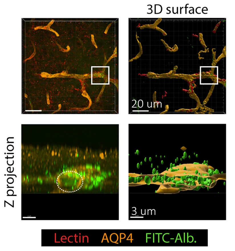 Open access visualization of Microscopy, Reconstructed Images, FITC-Albumin Leakage, Vessel Barriers, ECM