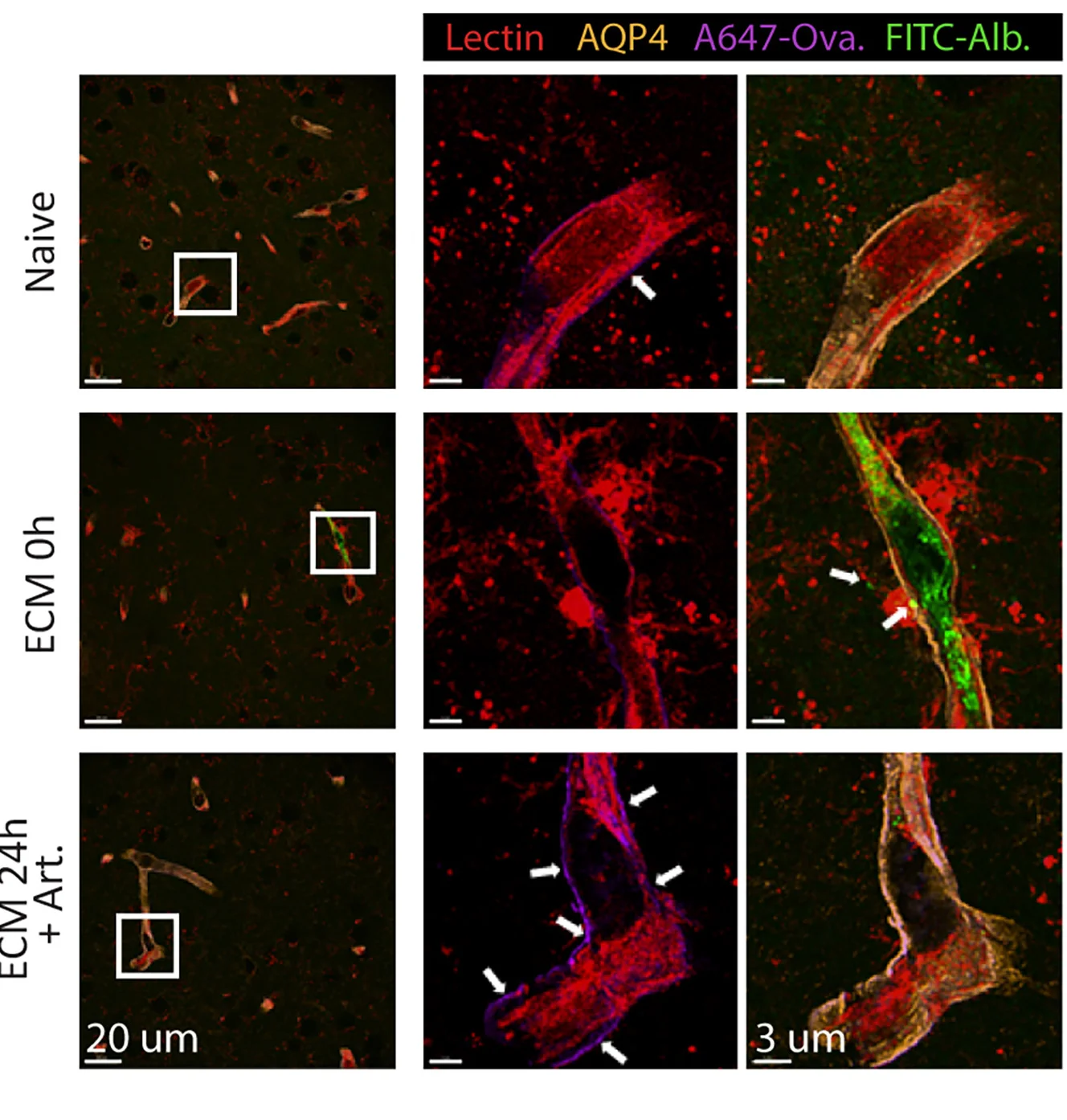 Open access visualization of Microscopy, Perivascular Location, CSF Tracer, Vascular Leakage, Naive Mice