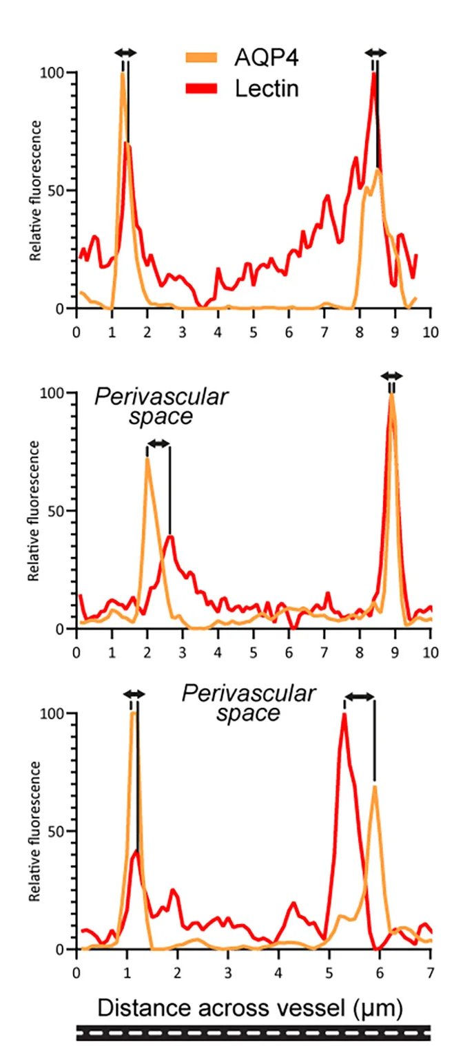 Open access visualization of Line Plot, Histograms, Endothelial Lining, Astrocyte Endfeet, Lectin