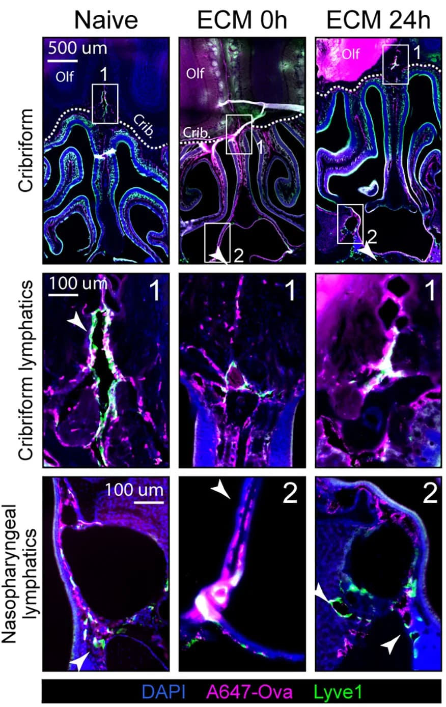 Open access visualization of Microscopy, Tracer Accumulation, Lyve-1+ Vessels, Cribriform Plate, Nasopharynx