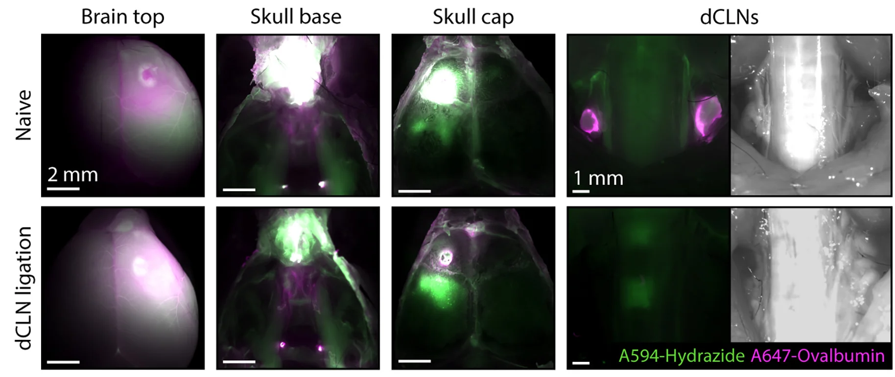 Open access visualization of Microscopy, Alexa 594, Alexa 647, Brain Parenchyma, Naive Mice