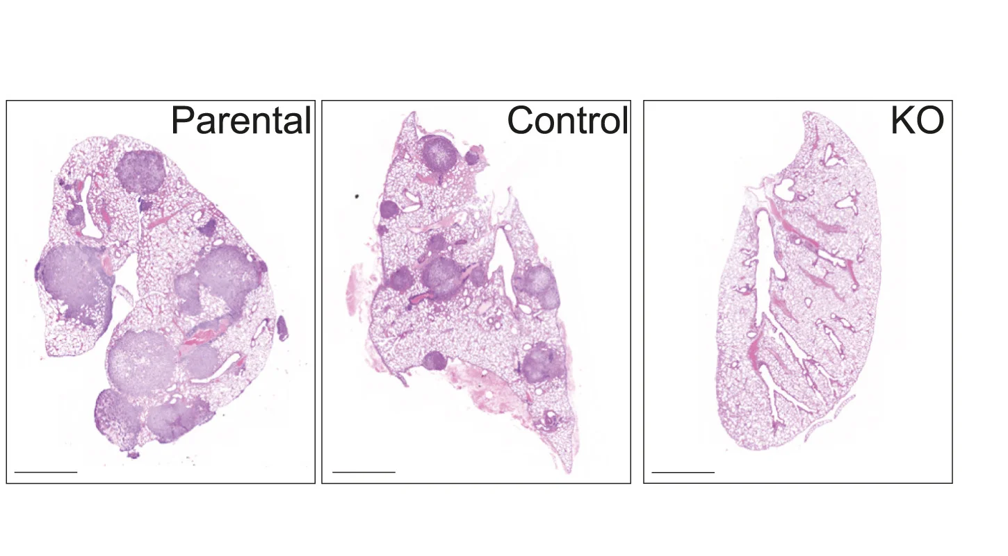 Open access visualization of Microscopy, H&E Staining, Mouse Lung Tissue, Intravenous Injection, Parental Cells