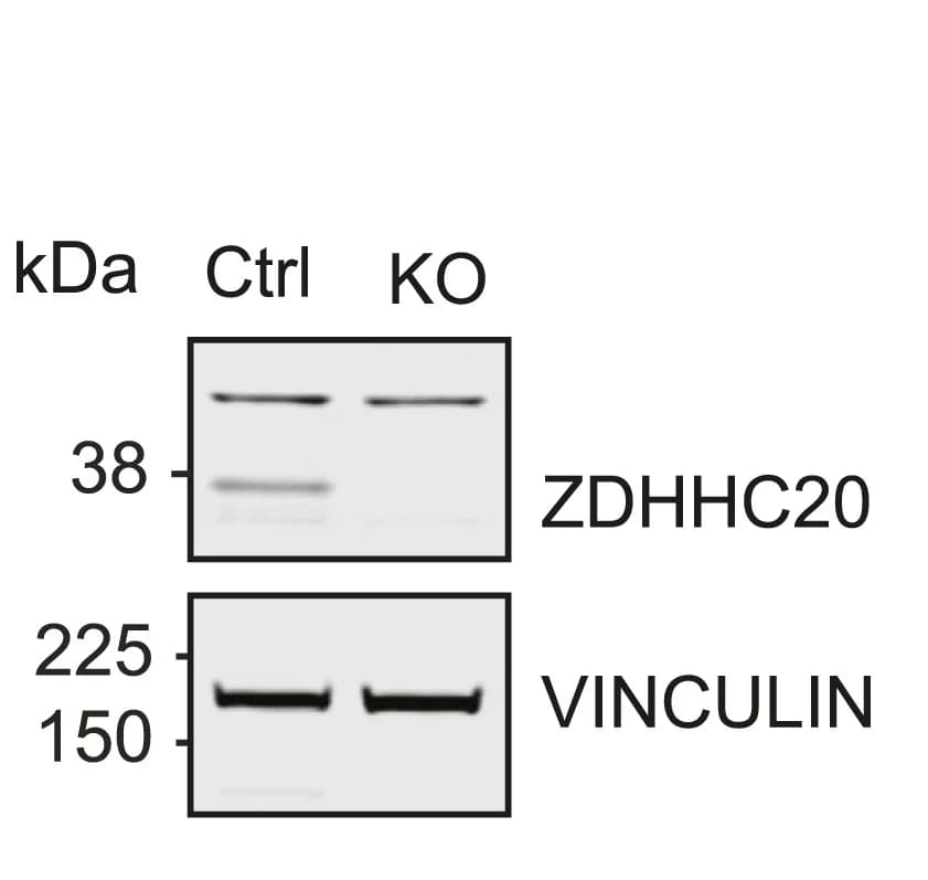 Open access visualization of Gel, Western Blot, ZDHHC20, Control Cells, KO Cells
