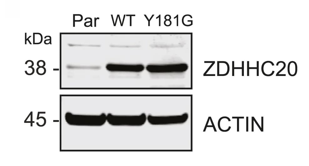 Open access visualization of Gel, Western Blot, ZDHHC20, Parental Cells, Overexpressing Cells