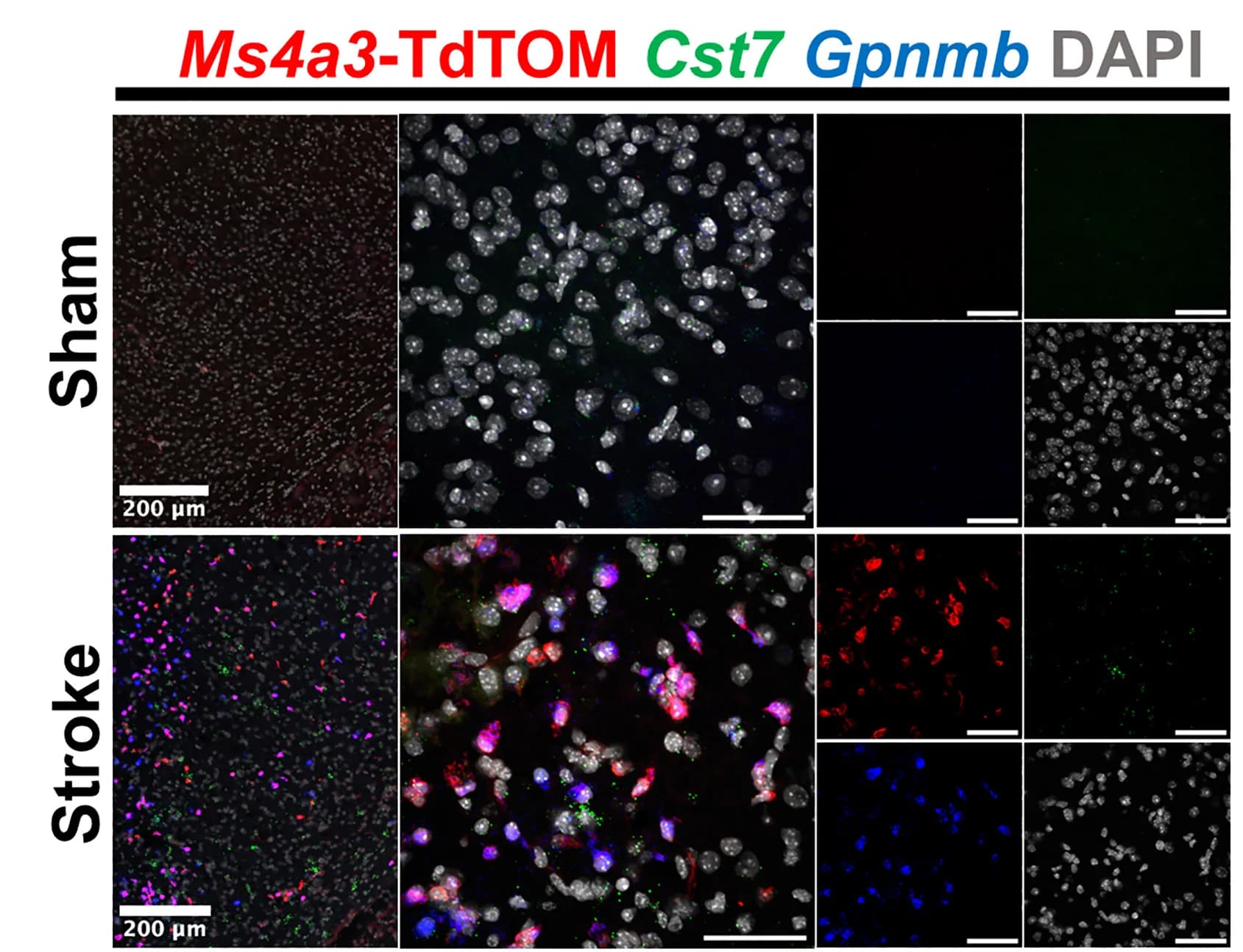 Open access visualization of Microscopy, Cst7 Transcripts, Gpnmb Transcripts, Brain Area, Stroke