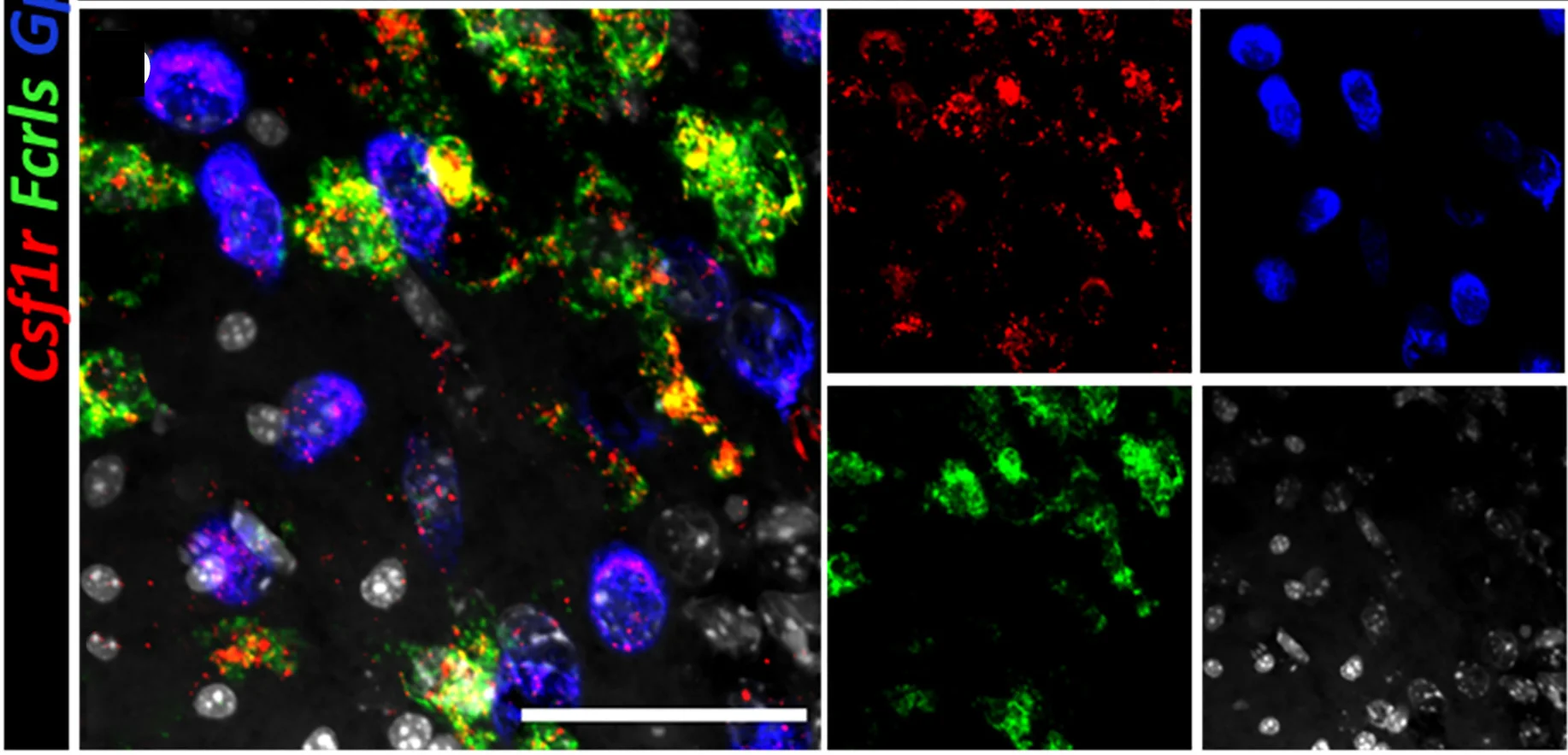 Open access visualization of Microscopy, Maximum Intensity Projection, Transcript Expression, Peri-Infarct Region, Individual Channels