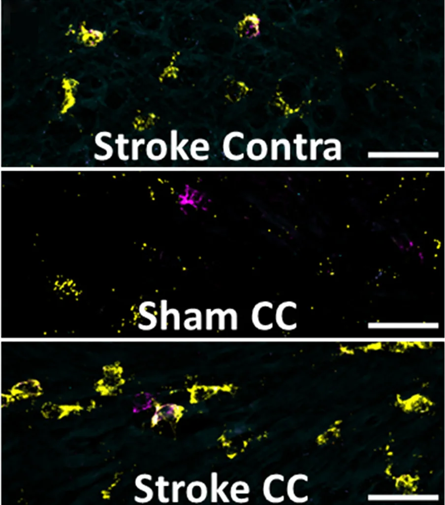 Open access visualization of Microscopy, Stroke Contra, Sham CC, Stroke CC