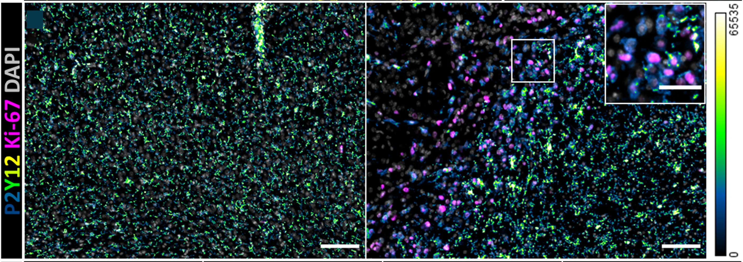Open access visualization of Microscopy, Ki-67, Sham Cortex, Stroke Peri-infarct, P2Y12