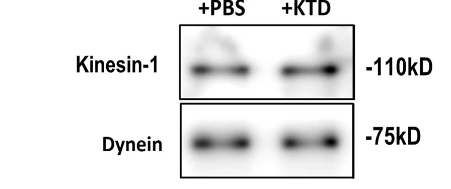 Open access visualization of Gel, Immunoblots, PA-SSLBs, SSLB Pull-Down Assay, Rat Brain Motor Fractions