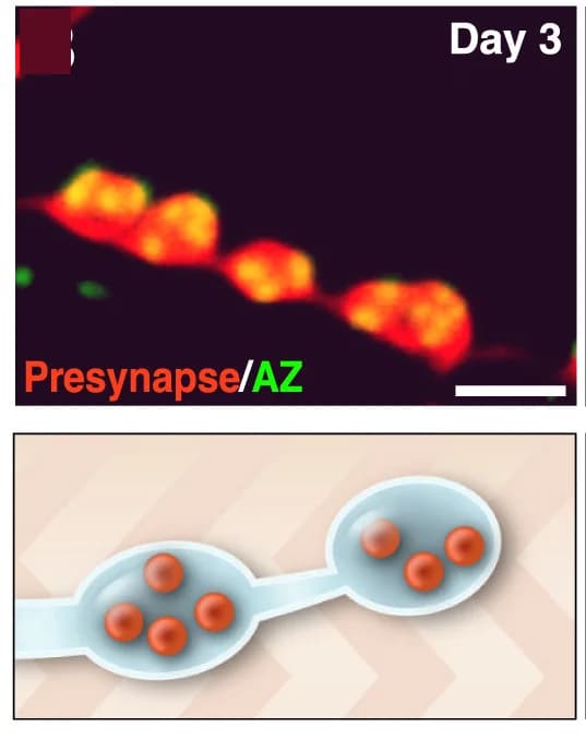 Open access visualization of Microscopy, Illustration, Synaptic Boutons, Motor Neurons, Drosophila