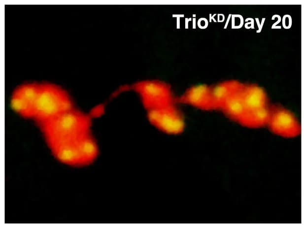 Open access visualization of Microscopy, Synaptic Boutons, Active Zones, Motor Neurons, GFP
