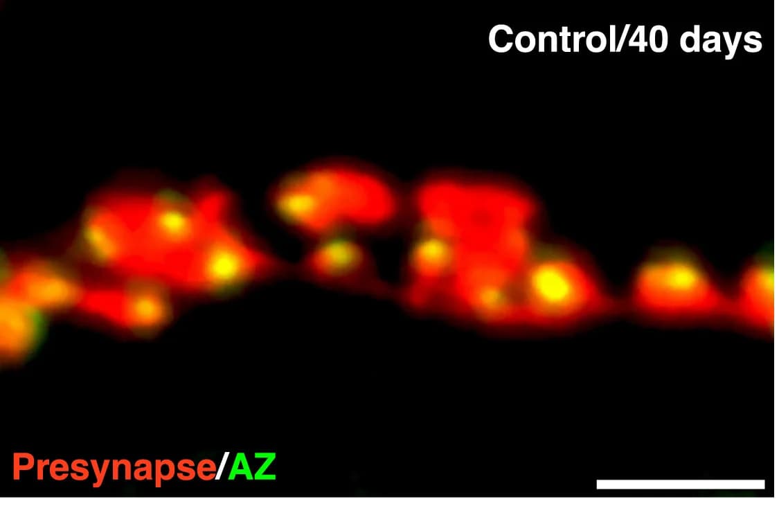 Open access visualization of Microscopy, HB9 Neuron Boutons, Active Zones, Control Animals, Trio Animals