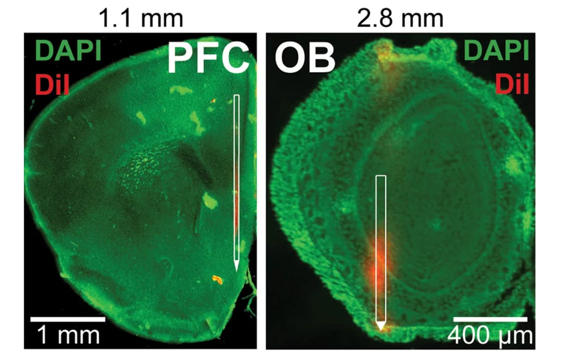 Open access visualization of Microscopy, Digital Reconstruction, DiI-Labeled Recording Electrode, PFC, OB