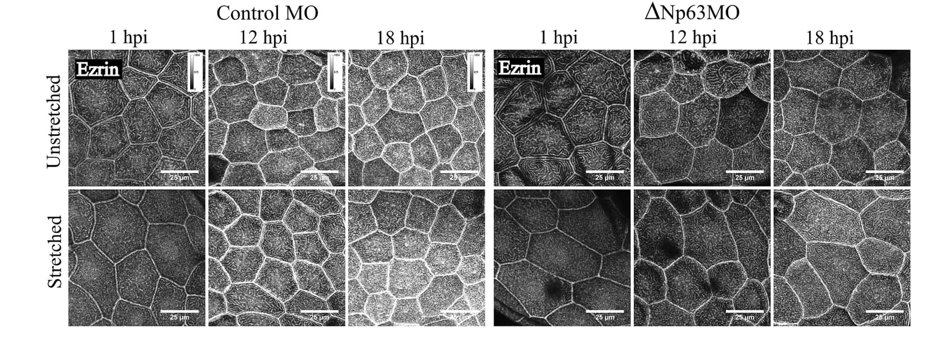 Open access visualization of Microscopy, Confocal Micrographs, Apical Localization, Ezrin, ΔNp63morphants