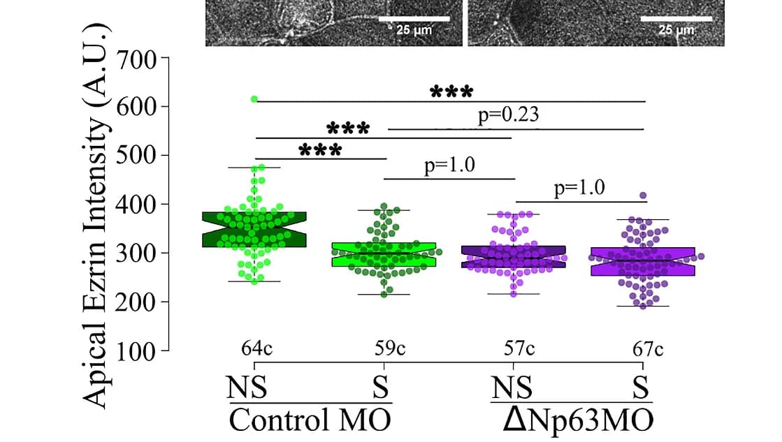Open access visualization of Box Plot, Scatter Plot, Boxplots, Apical Ezrin Fluorescence Intensity, ΔNp63morphants