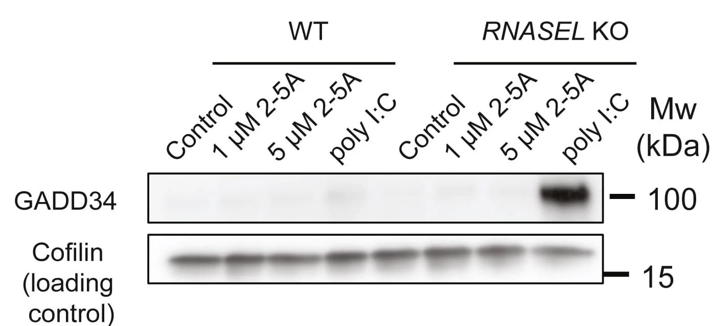 Open access visualization of Gel, Western Blot, GADD34, Protein Levels, poly(I:C)