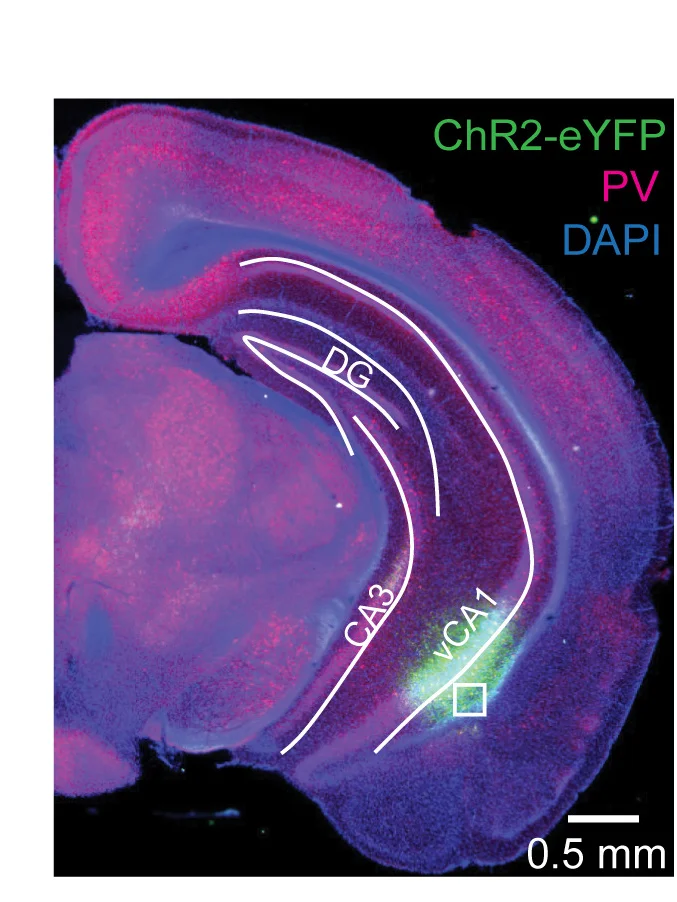 Open access visualization of Microscopy, Micrograph, ChR2 Expression, PV Interneurons, PV:Cre Mice
