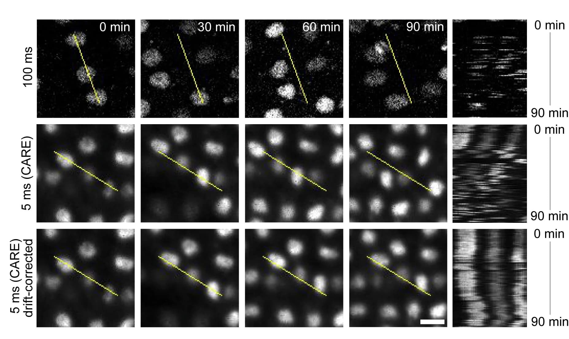 Open access visualization of Microscopy, Raw Imaging Data, CARE Denoising, 3D Drift Correction, Tissue Twitching