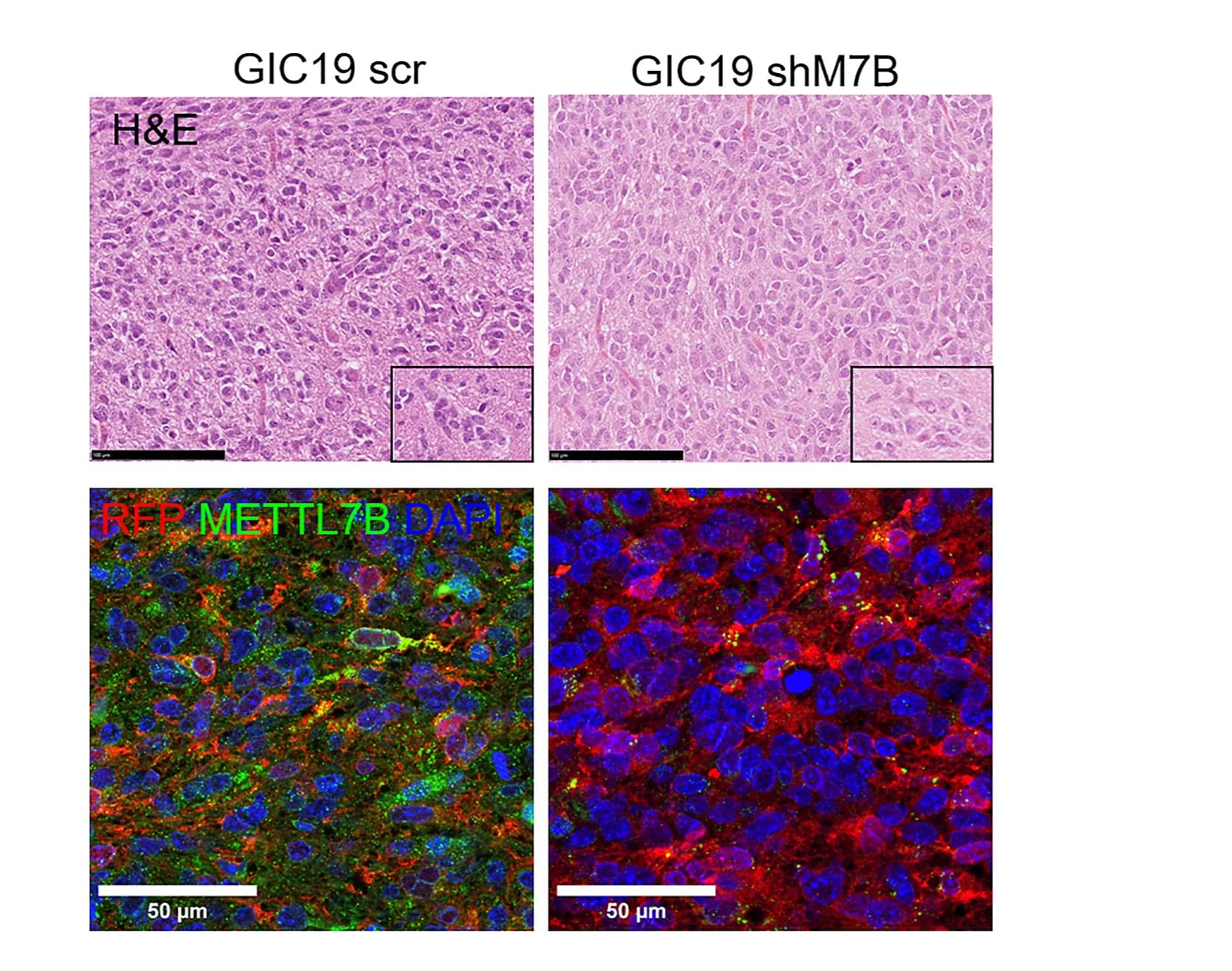 Open access visualization of Microscopy, Photo, H&E Staining, Xenografts, GIC19scr