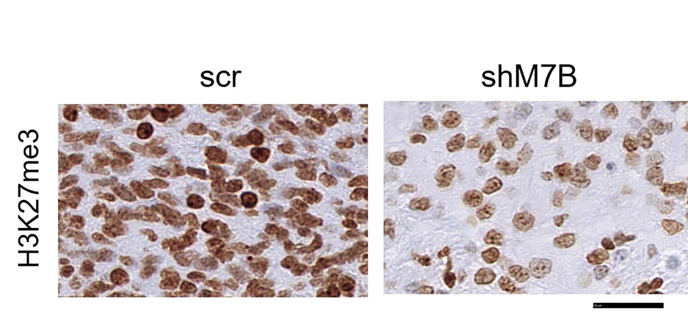 Open access visualization of Microscopy, IHC Staining, H3K27me3, GICscr, GICshM7B