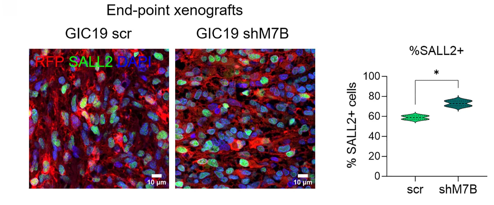Open access visualization of Microscopy, Violin Plot, Immunostaining, SALL2, Xenografts