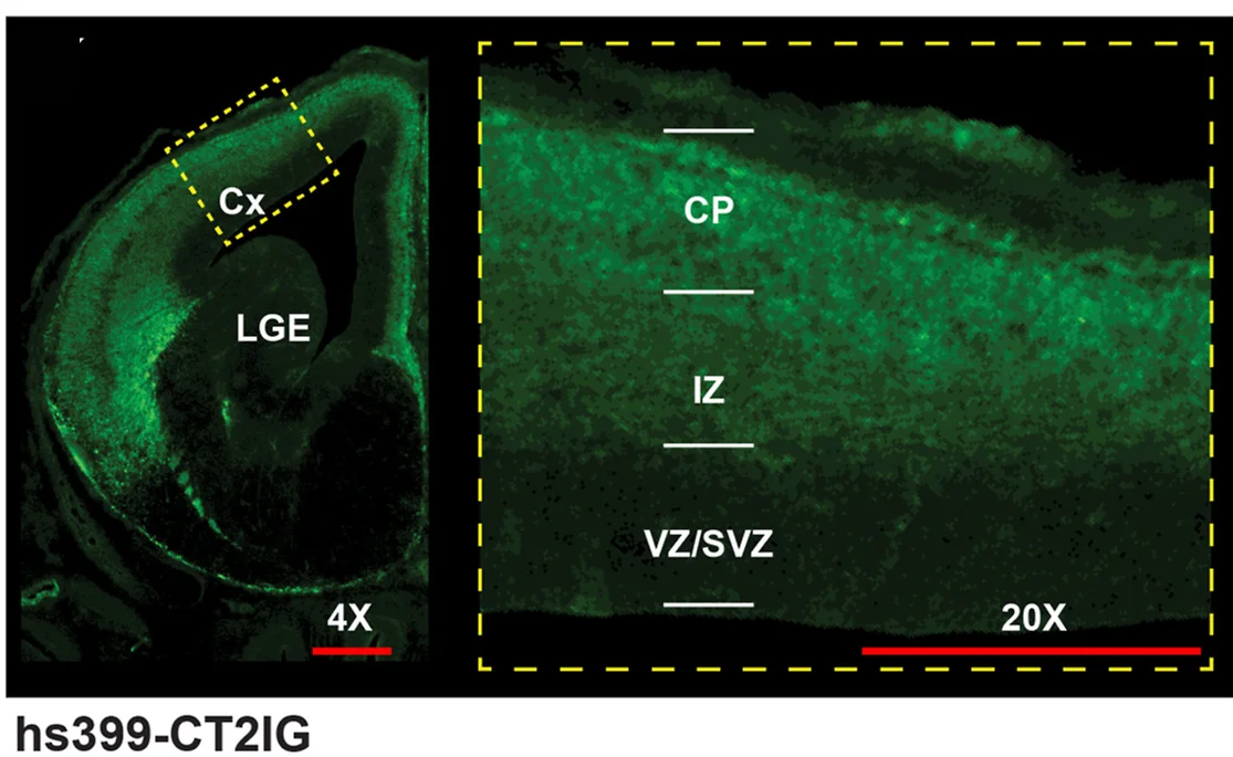 Open access visualization of Microscopy, hs399, Cortical Plate, Intermediate Zone, hs399-CT2IG enhancer transgenic mouse