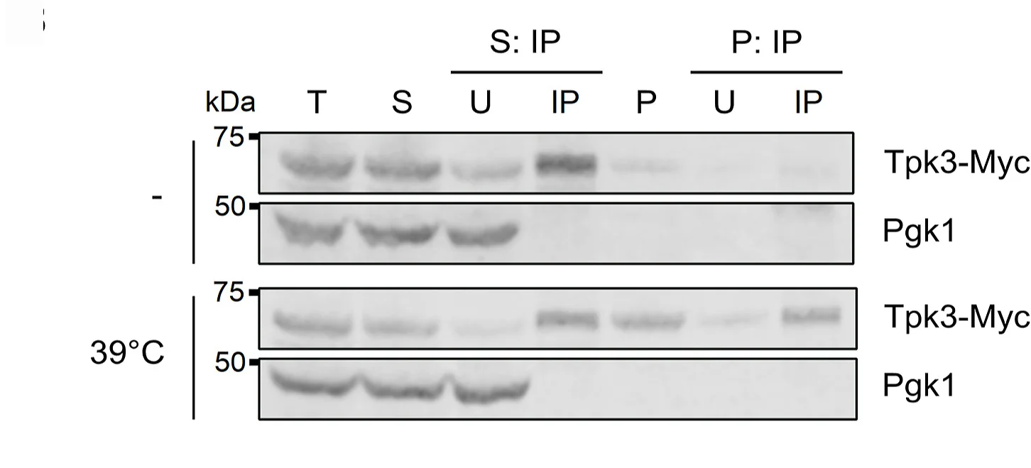 Open access visualization of Gel, Immunoblot, Tpk3-Myc, Pellet Fraction, Myc Antibody