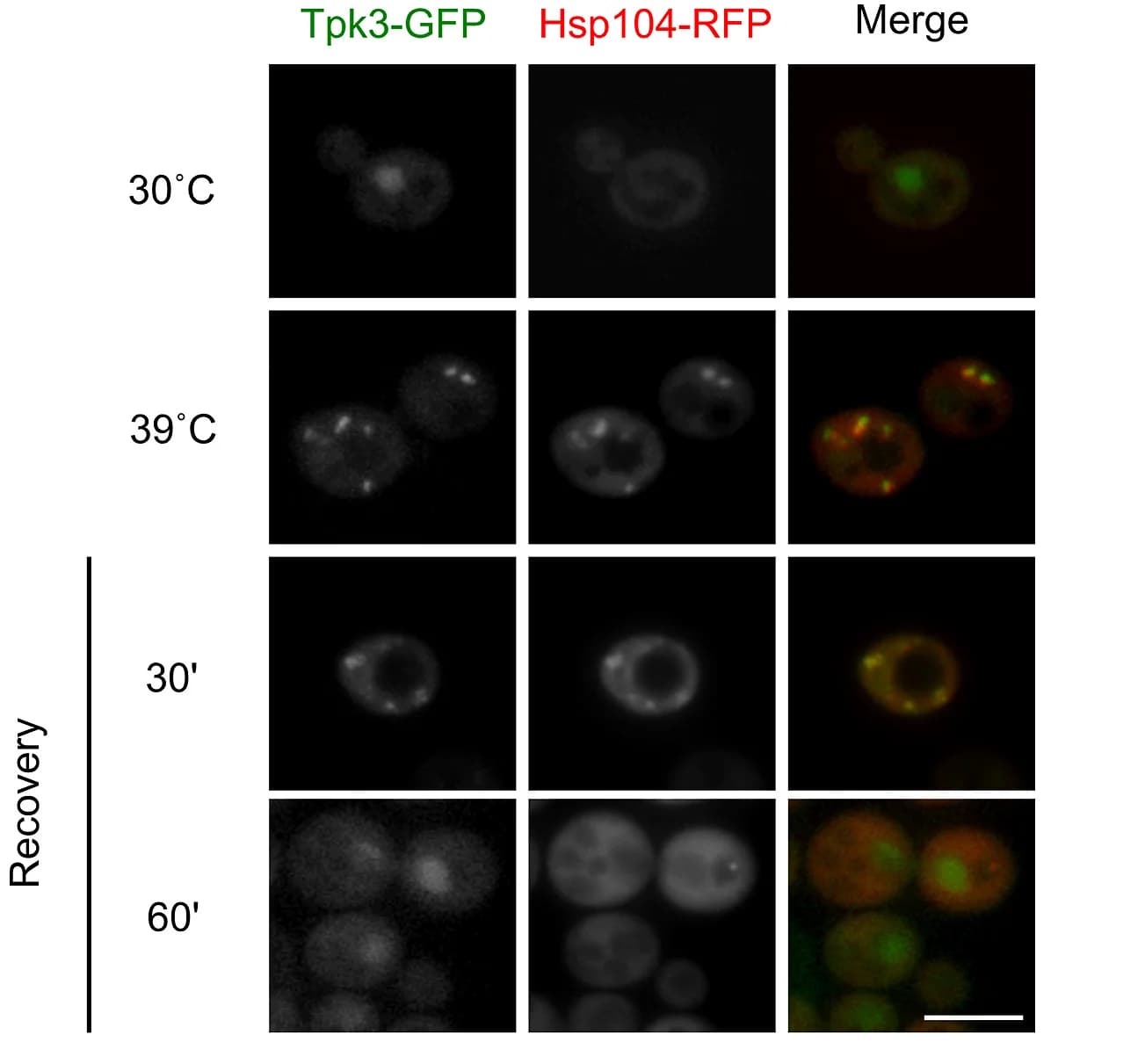 Open access visualization of Microscopy, Tpk3-GFP, Hsp104-RFP, Reversible Foci, Scale Bar