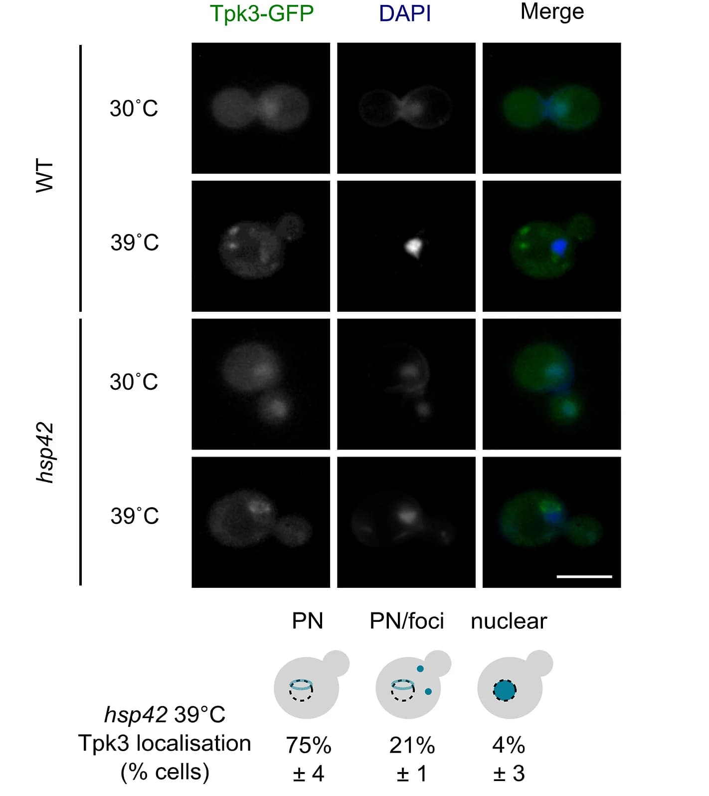 Open access visualization of Microscopy, Illustration, Table Image, Tpk3-GFP, Scale Bar