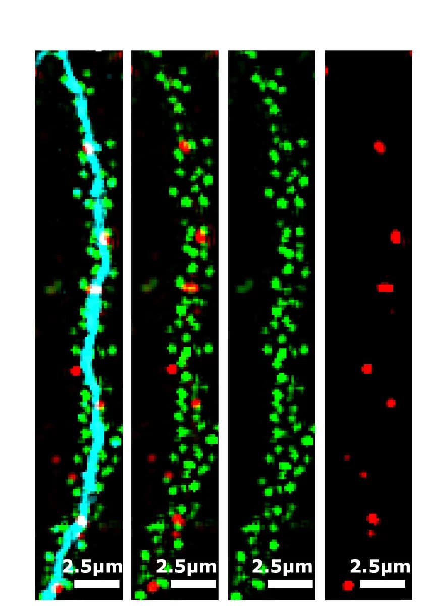 Open access visualization of Microscopy, Pyramidal Neurons, CA1, Hippocampus, Spatial Resolution