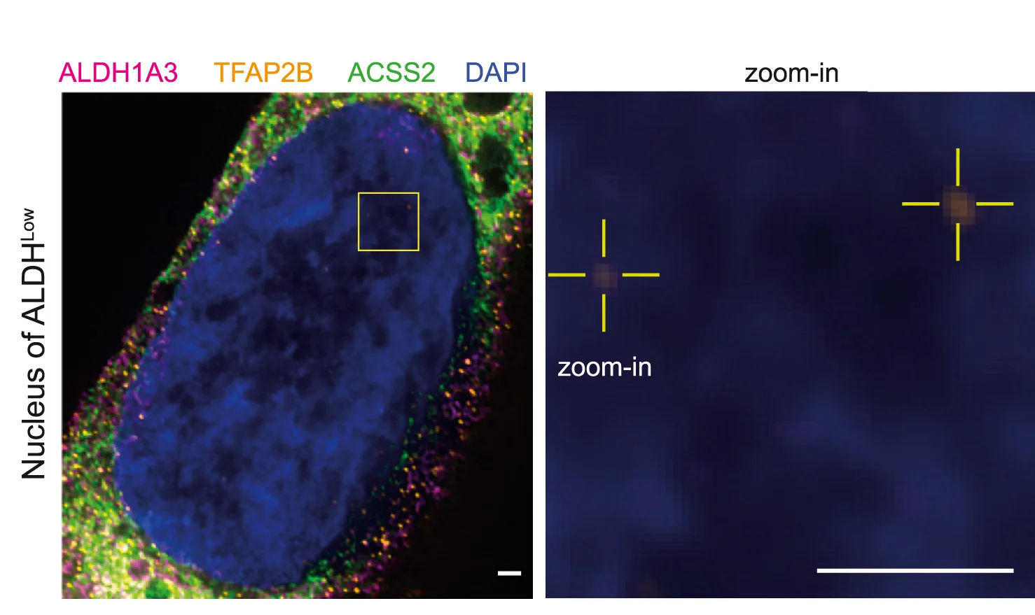Open access visualization of Microscopy, ALDH1A3, ACSS2, TFAP2B, Co-localization