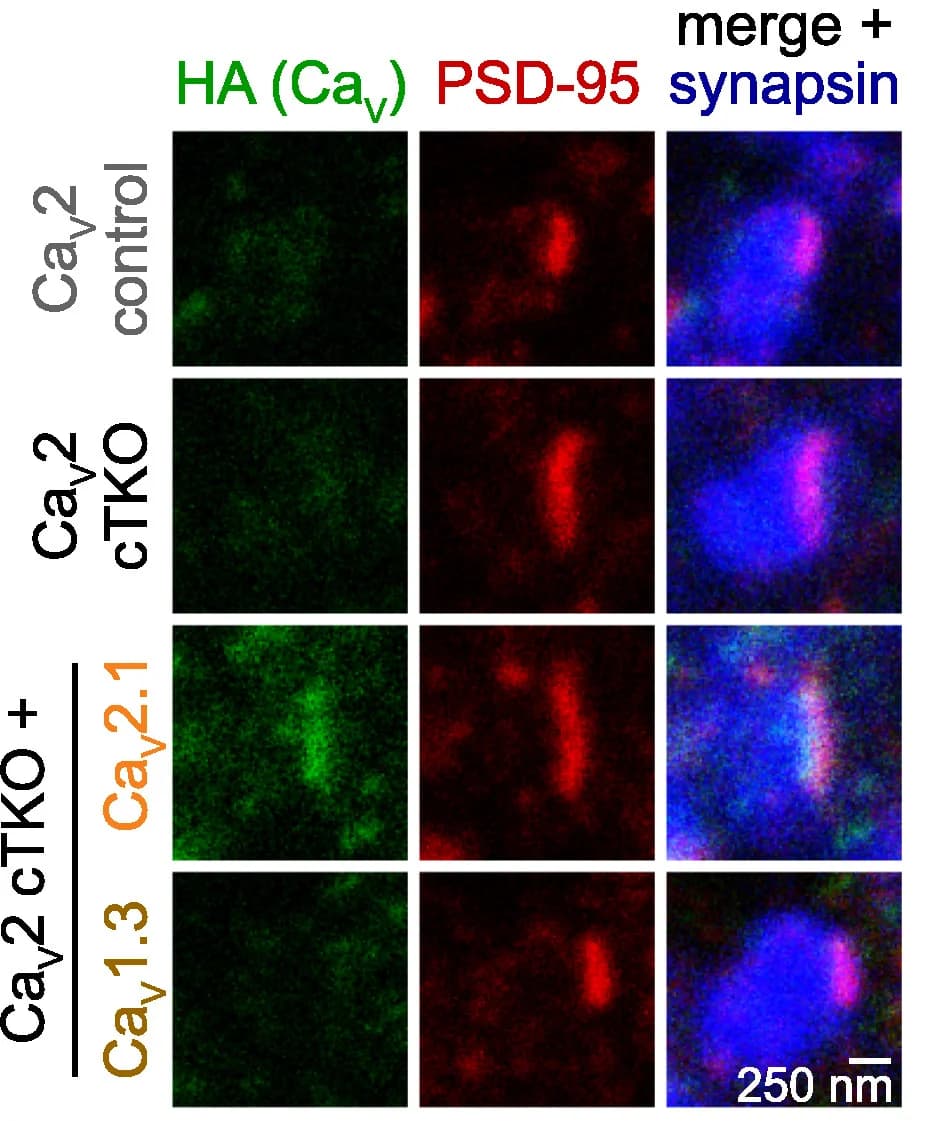Open access visualization of Microscopy, Synapses, HA, Lentivirally Expressed CaVs, STED Microscopy