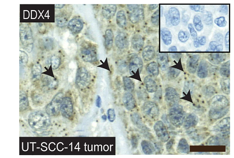 Open access visualization of Microscopy, Immunohistochemistry, Xenograft Tumors, DDX4 Antibody, DDX4 Granules