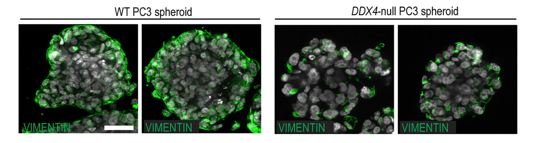 Open access visualization of Microscopy, Immunofluorescence, WT PC3 Spheroids, DDX4-null PC3 Spheroids, Vimentin Antibody