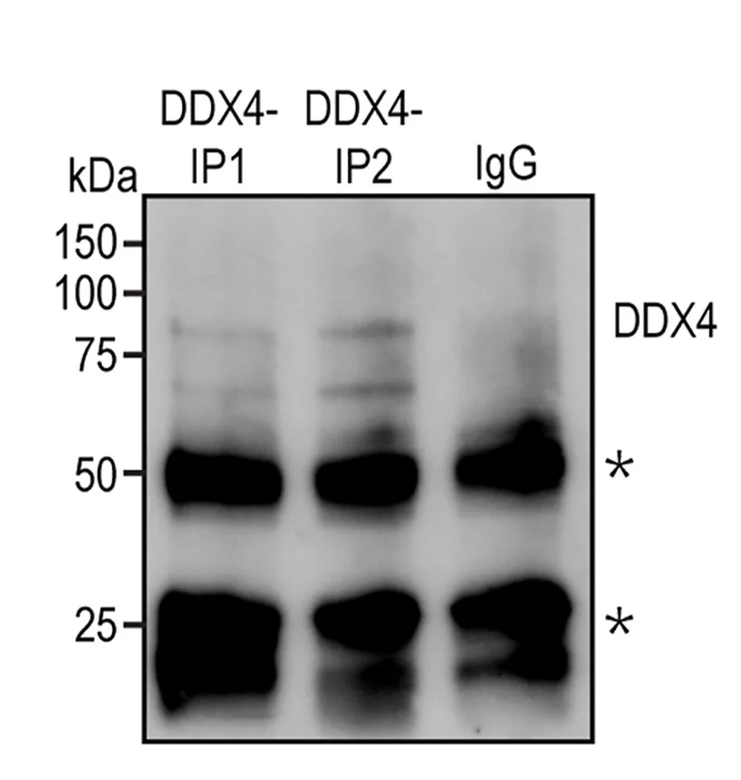 Open access visualization of Gel, PC3 Tumors, DDX4 Antibody, Western Blotting, IgG IP