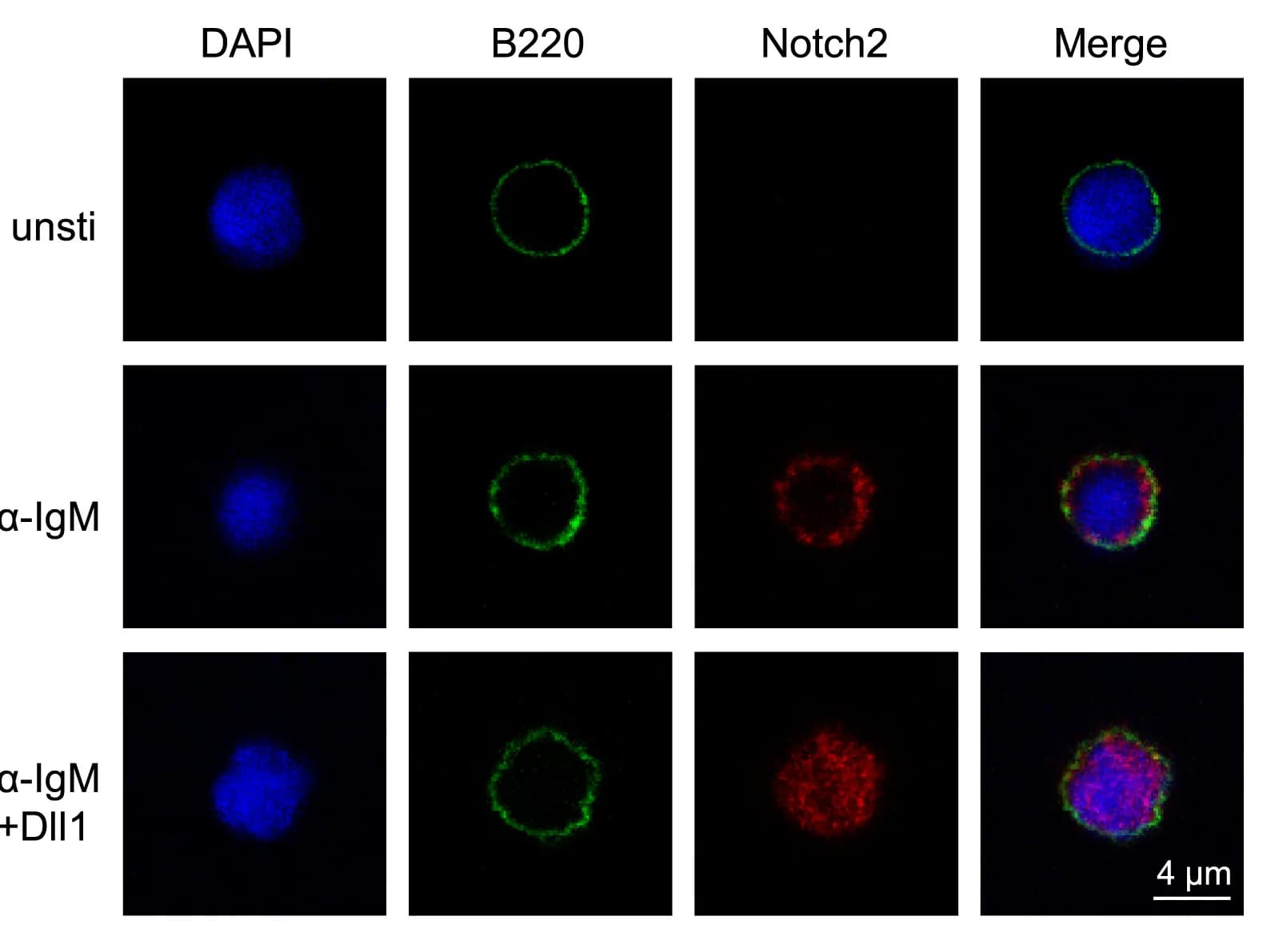 Open access visualization of Microscopy, Immunofluorescence Images, B Cells, α-IgM, Dll1-OP9 Cells