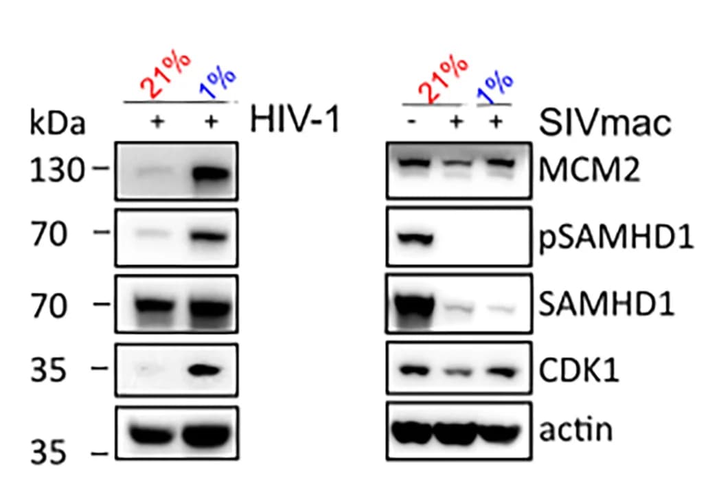 Open access visualization of Gel, Western Blots, HIV-1, SIVmac, Normoxia
