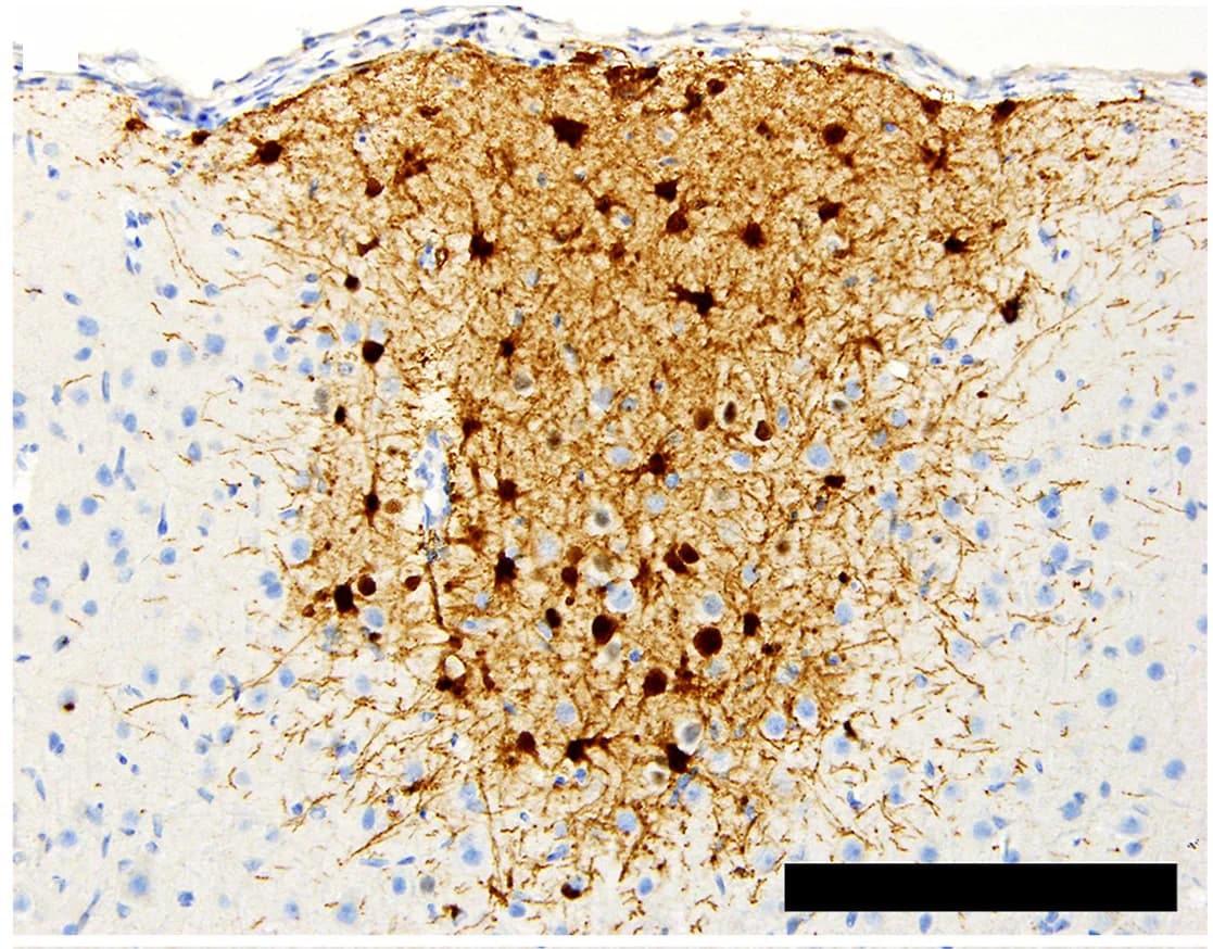 Open access visualization of Microscopy, Histopathology, Immunohistochemistry, CNS Infection, Cortical Astrocytes