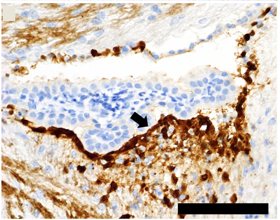 Open access visualization of Microscopy, Histopathology, Immunohistochemistry, CNS Infection, Ventricular Ependyma