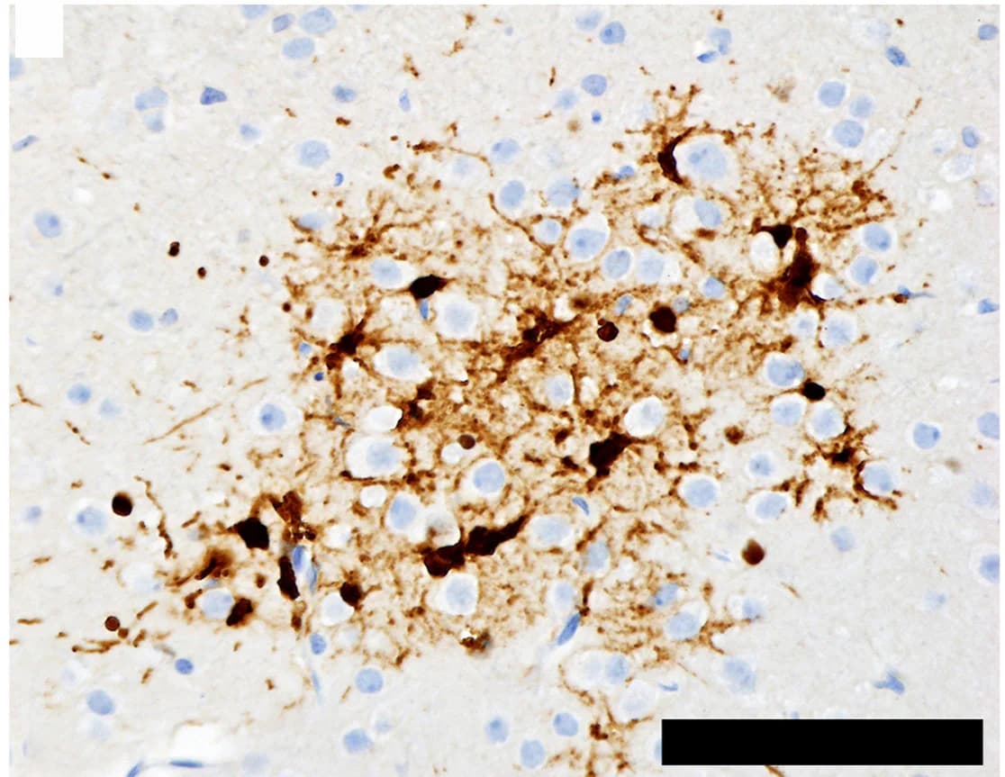 Open access visualization of Microscopy, Histopathology, Immunohistochemistry, CNS Infection, Glial Cells
