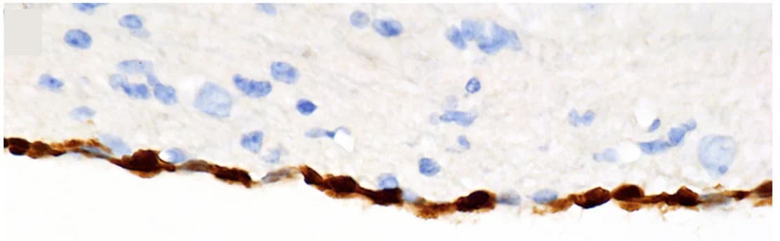 Open access visualization of Microscopy, Histopathology, Immunohistochemistry, CNS Infection, Ependymal Cells