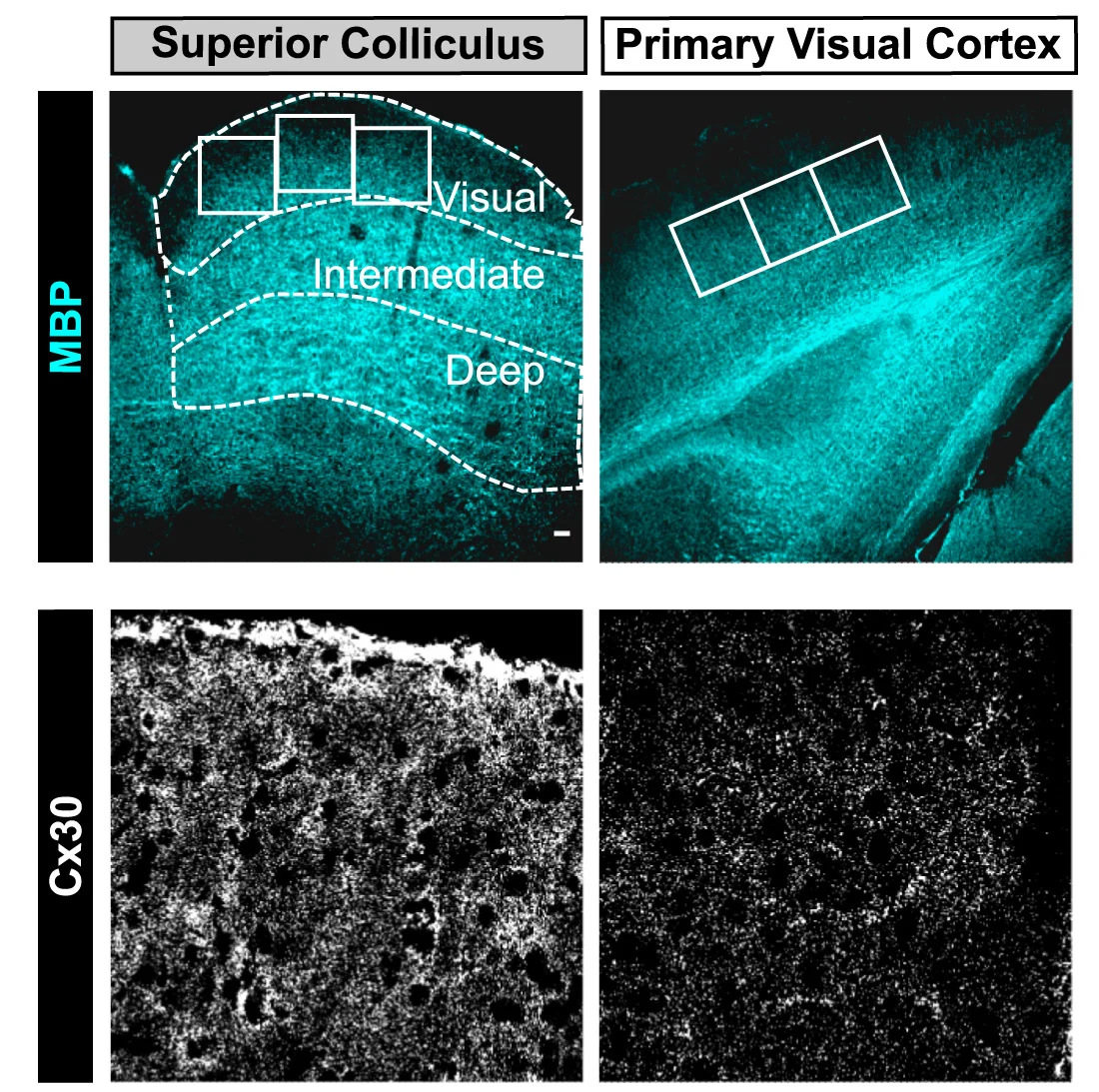 Open access visualization of Microscopy, Brain Tissues, Immunostaining, Myelin Basic Protein, Connexin 30