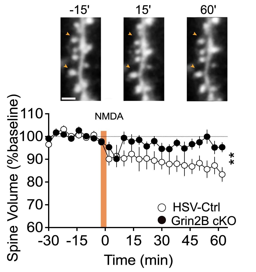 Open access visualization of Line Plot, Error Bars, Microscopy, Photo, Grin2B