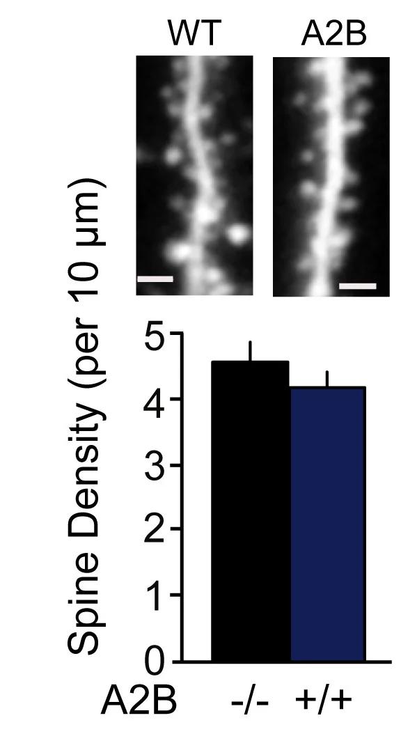 Open access visualization of Bar Plot, Error Bars, Microscopy, GluN2B CTD, Spine Density