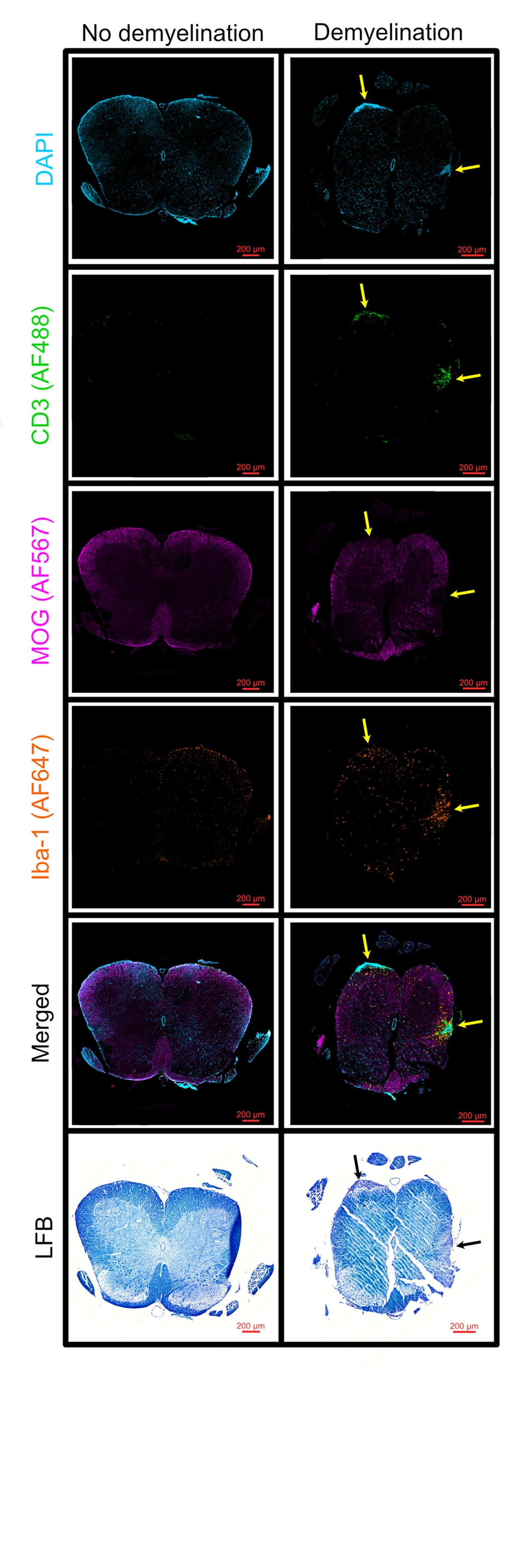 Open access visualization of Microscopy, Immunofluorescence, Luxol Fast Blue Staining, Demyelination, Myelin Oligodendrocyte