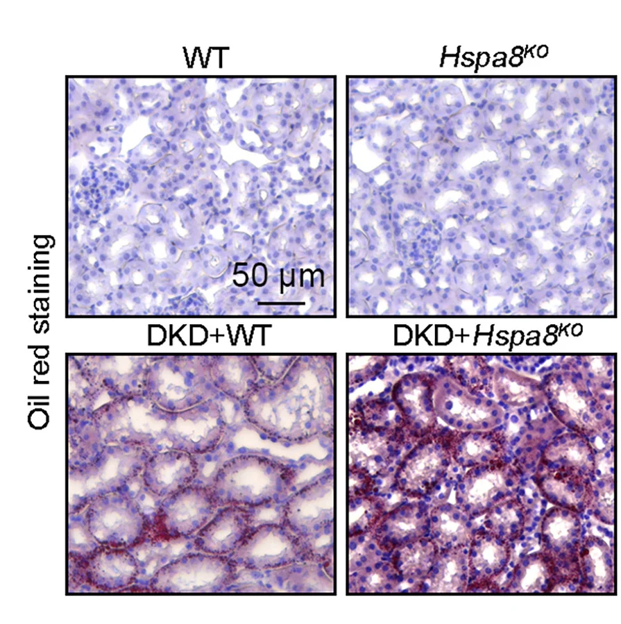Open access visualization of Microscopy, Oil Red O Staining, Triglycerides, Kidney, DKD Mice