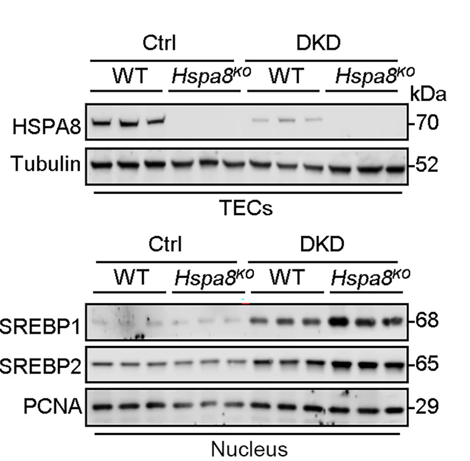 Open access visualization of Gel, Nuclear Fractions, DKD Mice, Kidney, Western Blotting