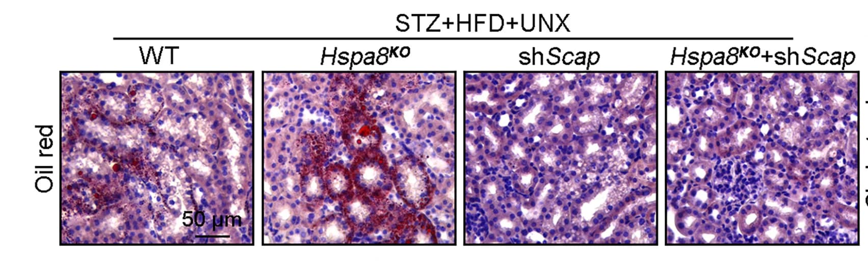 Open access visualization of Microscopy, Oil Red O Staining, Kidney Sections, Cholesterol, Triglyceride