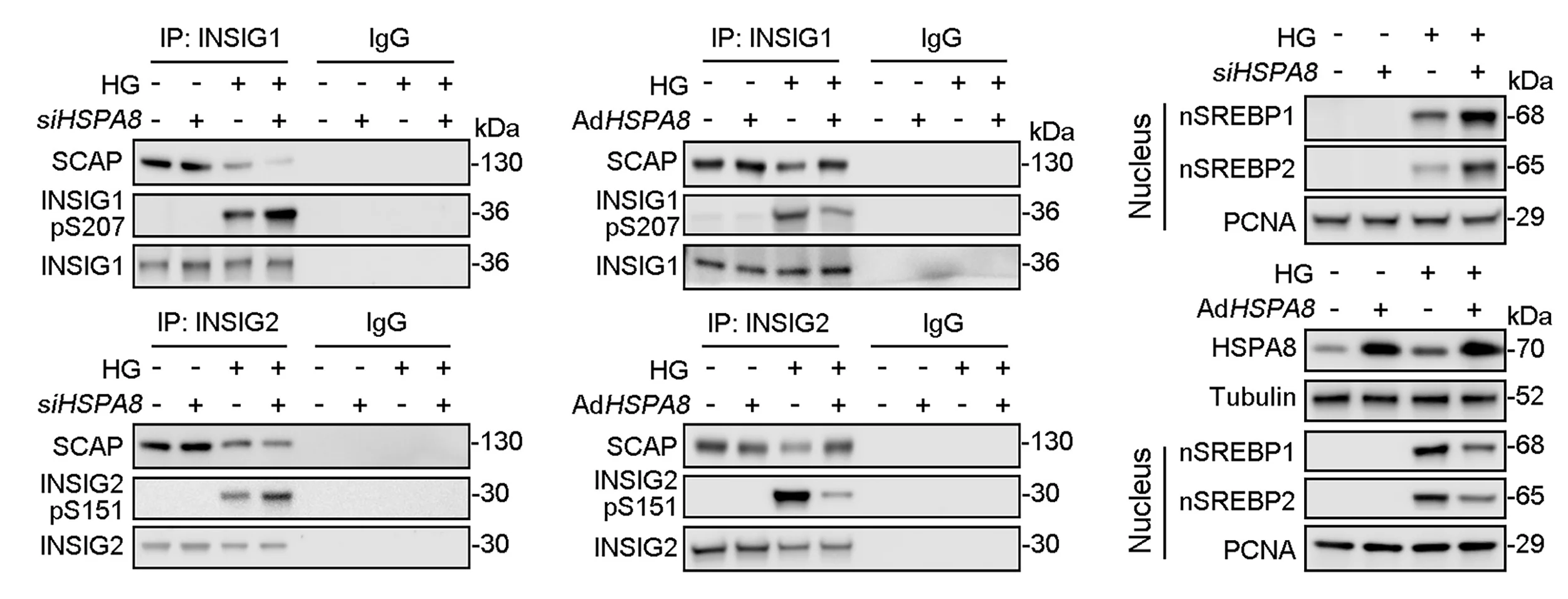 Open access visualization of Gel, Cell Lysates, CoIP, INSIG1 Antibody, INSIG2 Antibody
