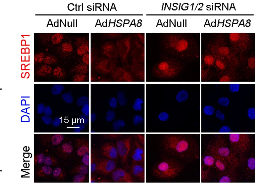Open access visualization of Microscopy, Immunofluorescence Staining, SREBP1, HK2 Cells